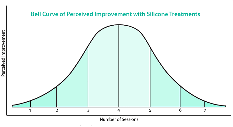 Bell Curve
