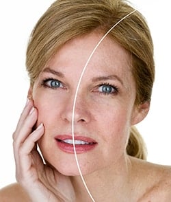 Skin Lesions th Skin Lesions th