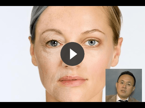fillers video