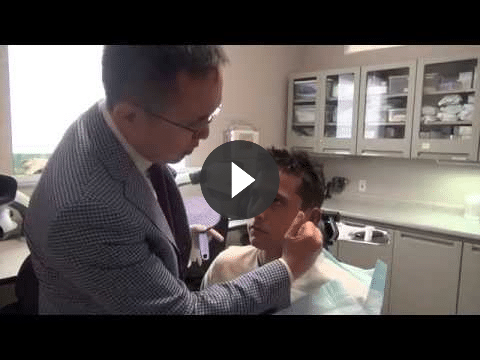 otoplasty video