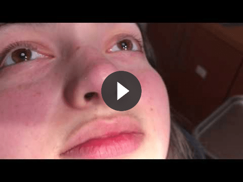 rhino video