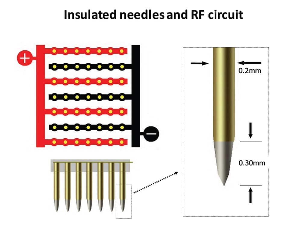 RF Microneedle