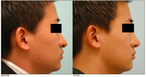 asian_face_tutorial_20