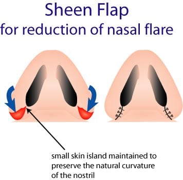 asian_face_tutorial_22