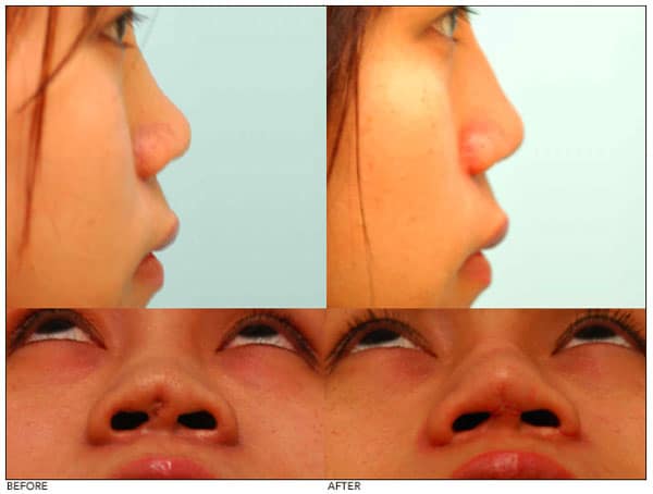 asian_face_tutorial_25