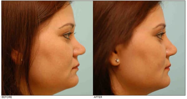 asian_face_tutorial_26