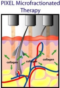 skin_rejuvenation_tutorial_3