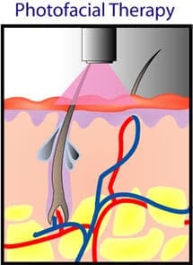 skin_rejuvenation_tutorial_8
