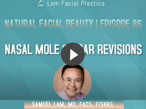 Nasal Mole Scar Revisions th