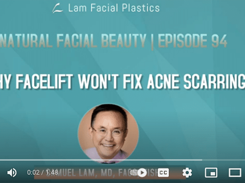 Acne Scarring