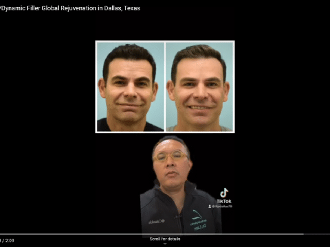 botox video Youtube