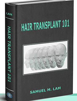 Hair Transplant 101 Hair Transplant 101