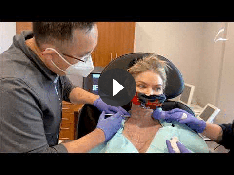 Chest and Neck Area Treatment video thumb