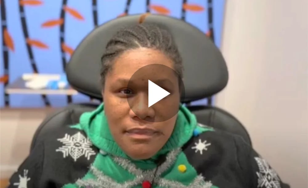 Osteoma Removal Testimonial One Week After video thumb