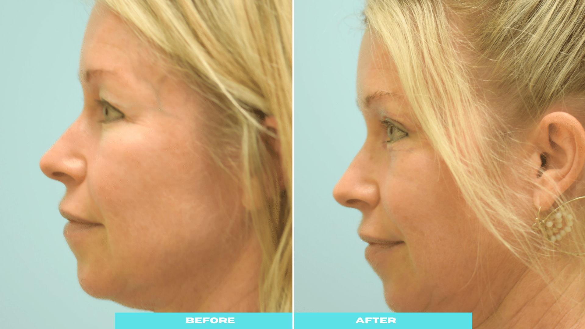 6_14-cos-5