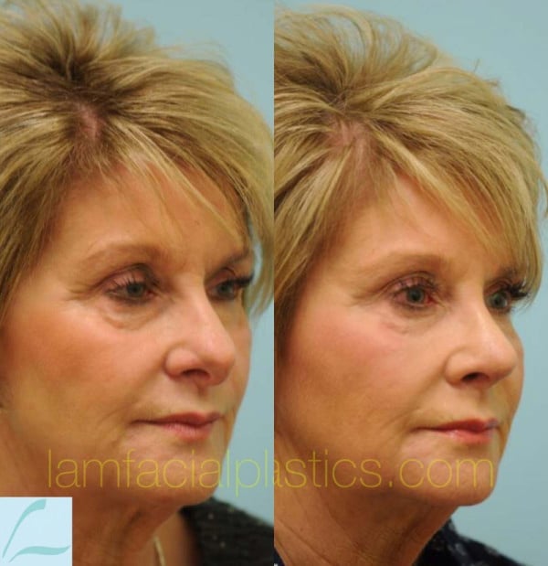 17308-02of06